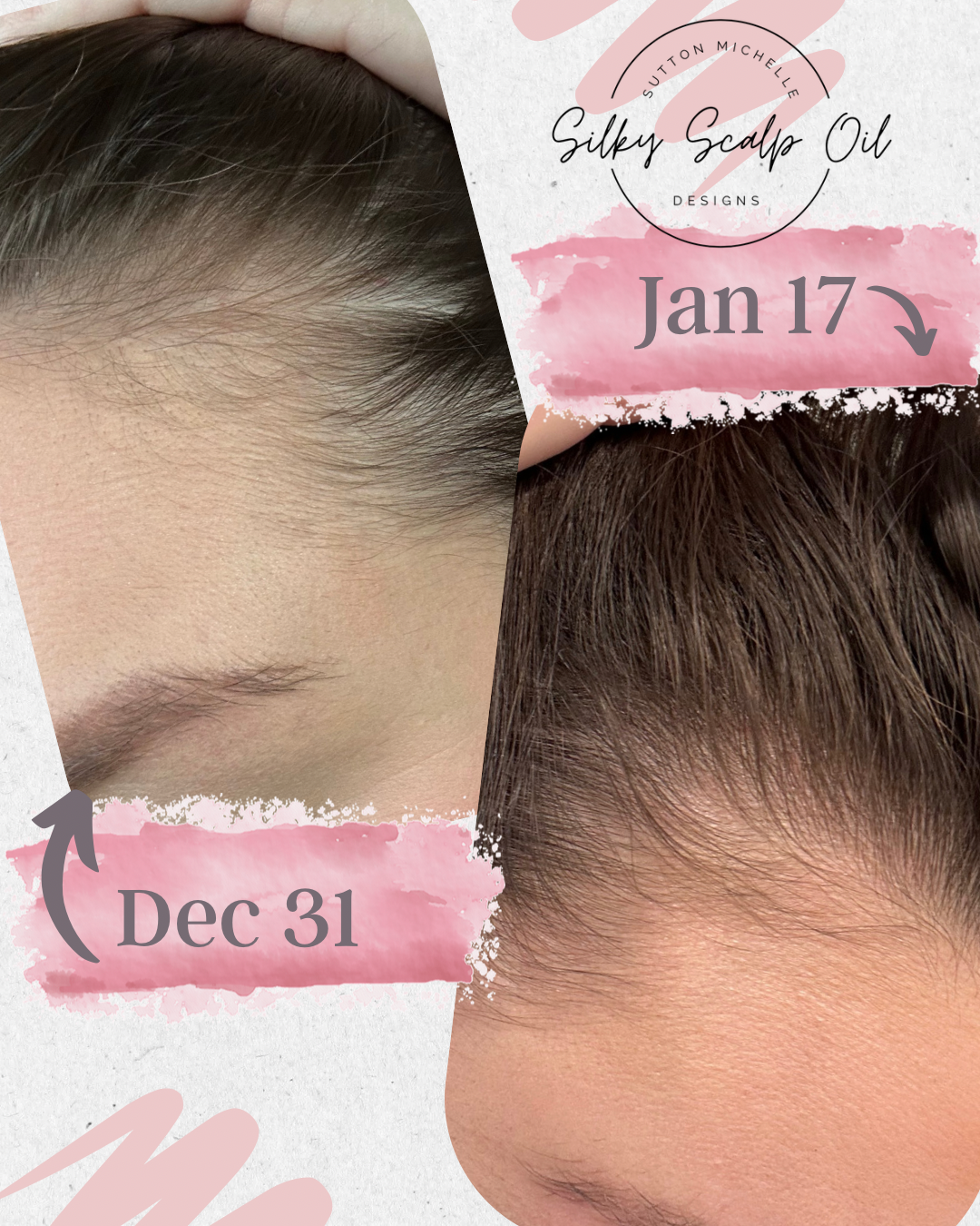 Sutton Michelle Designs - Wholesale Hair Oil - Growth Scalp Oil6