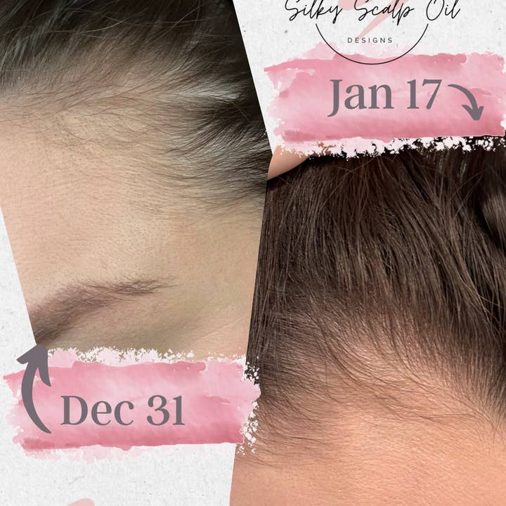 Sutton Michelle Designs - Wholesale Hair Oil - Growth Scalp Oil6