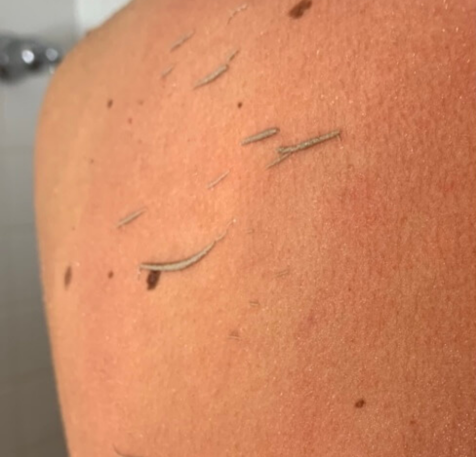 Wildpier Beauty – Engroshandel Eksfolierende handsker/vanter – Wildpier ™️ Deep Exfoliating Handske og Konjac Sponge Double B5