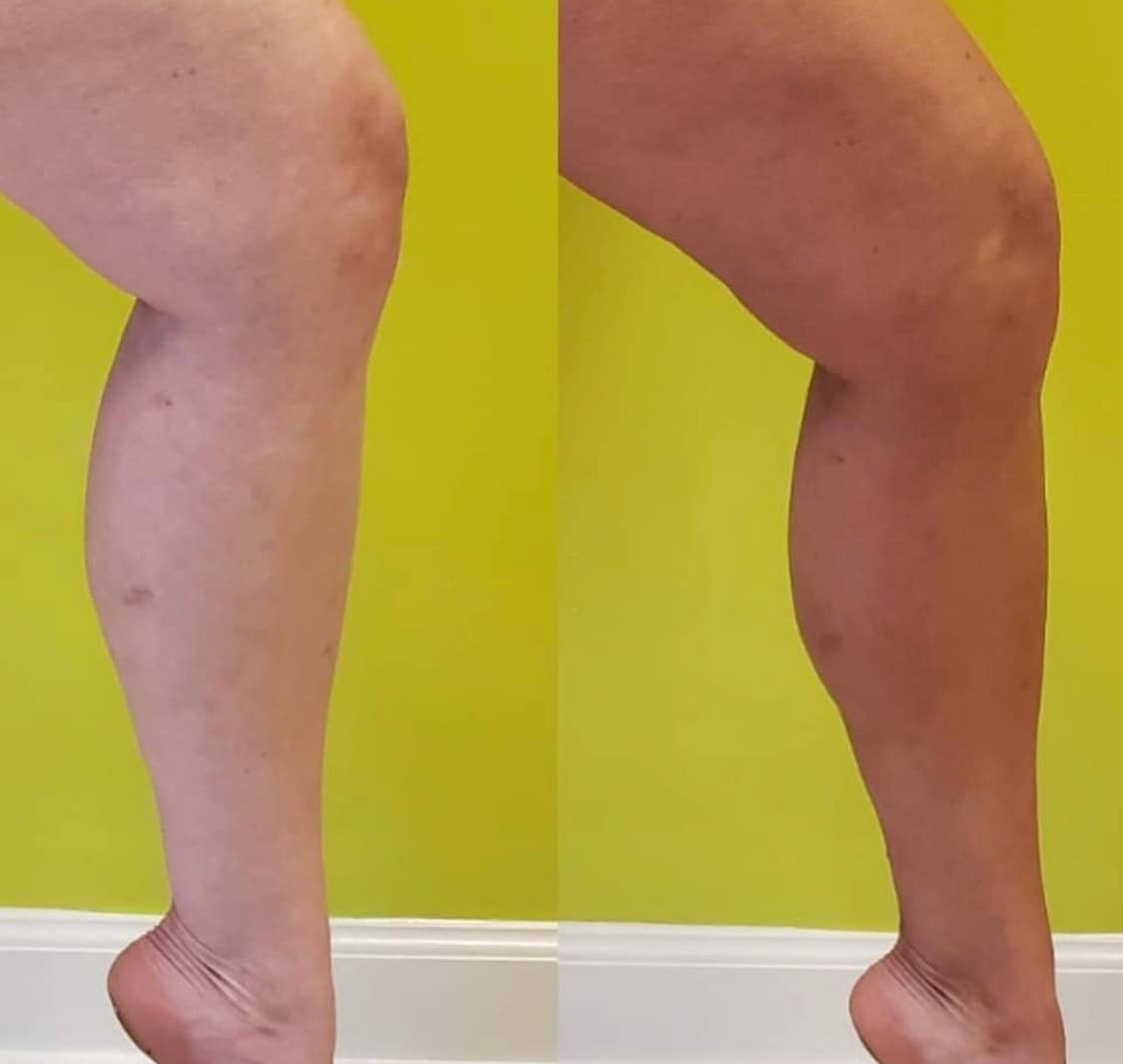 Beettan LLC – Großhandel Selbstbräuner – BEETTAN Selbstbräunungsmousse (mittel-dunkel)8