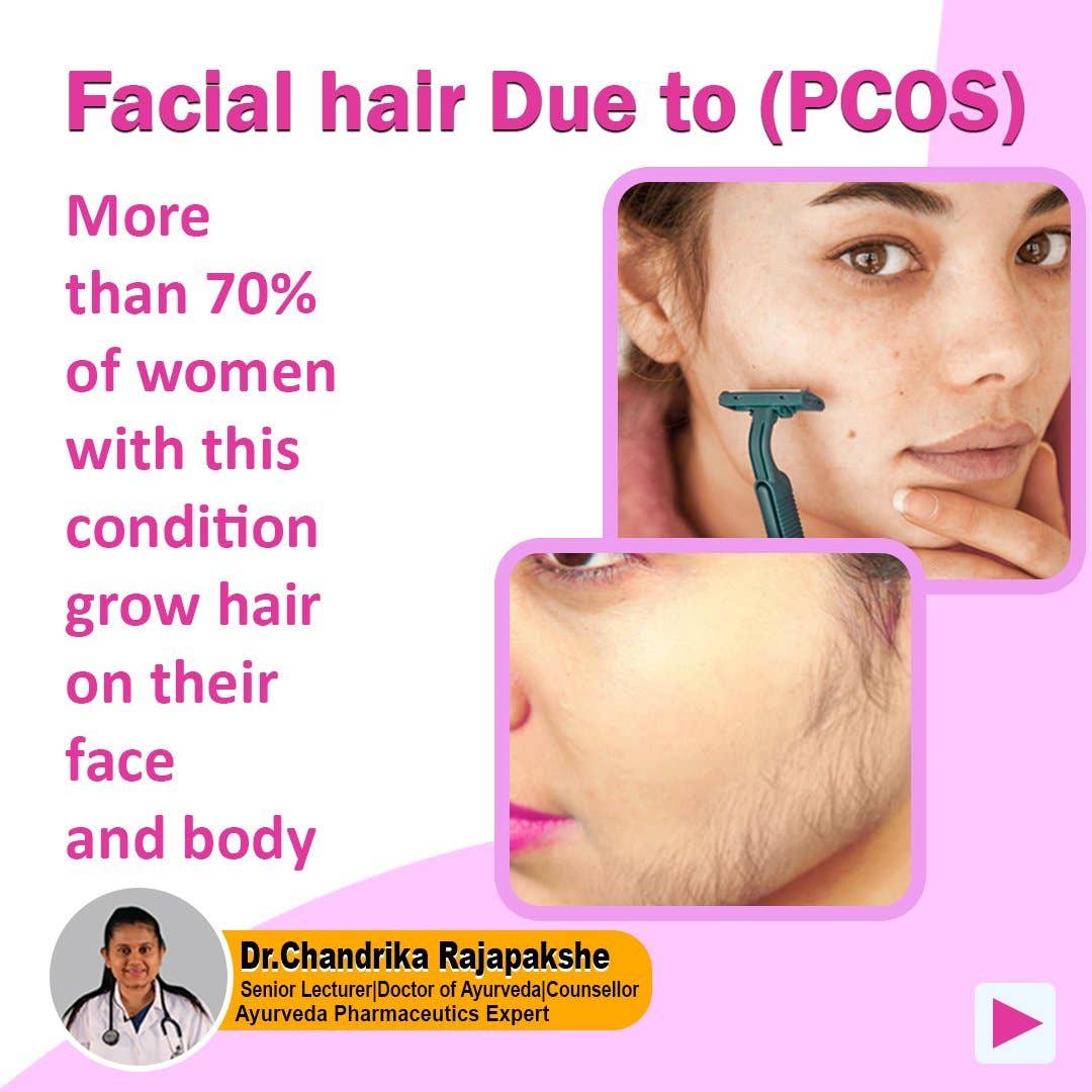 Secrets Of Tea - Wholesale Health/Detox Tea - Secrets Of Tea PCOS & PMS Be Gone Tea Support for Women - Symptom Relief, Mood, Acne, Skin darkens, and Menstrual Pain.3