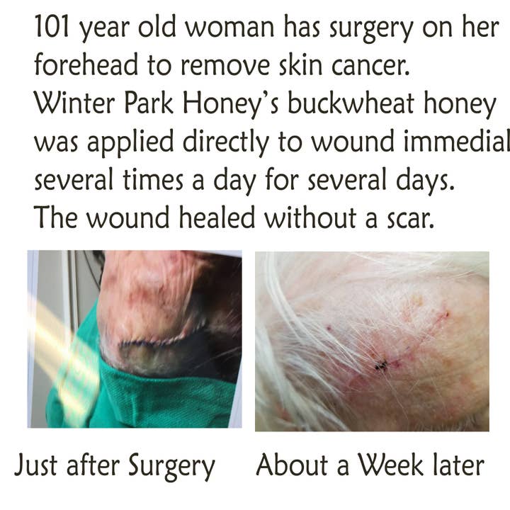 Winter Park Honey – Engroshandel Honning – Boghvede honning - 16 oz | Winter Park honning (ren rå)
