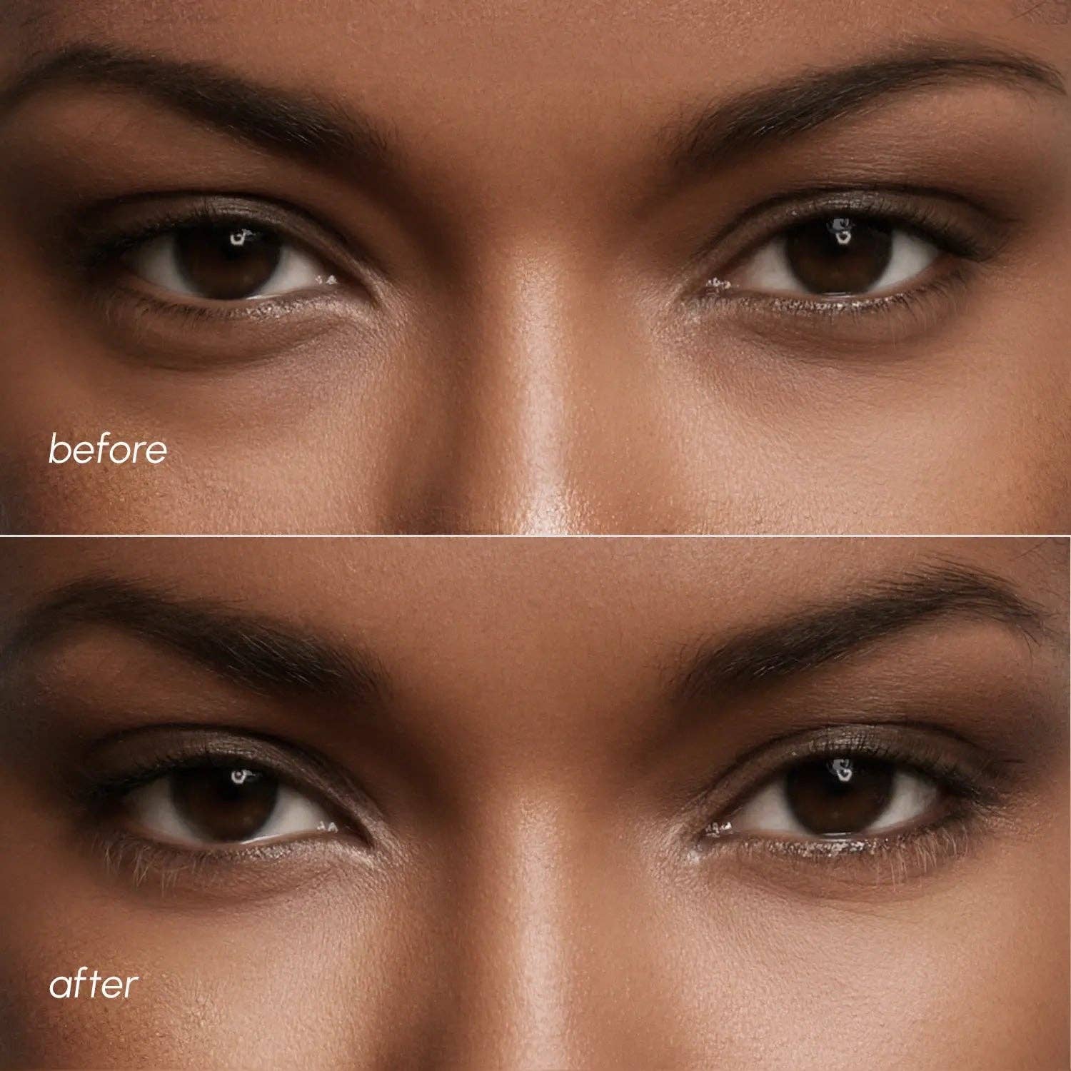 VIAI Beauty - Wholesale Eye Treatment Mask - MAREE Violet Eye Patches for Dark Circles4