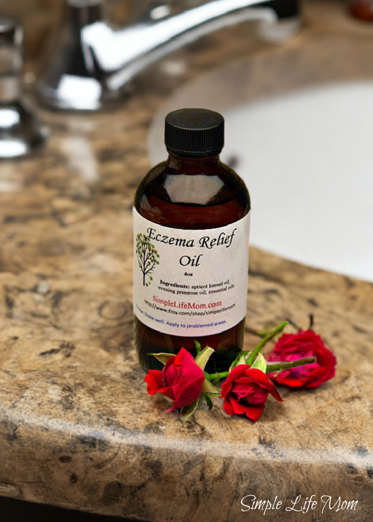 Simple Life Mom - Wholesale Bath/Body Oil - ECZEMA RELIEF OIL - 4oz soothe irritated, dry skin, organic body oil with essential oils, dermatitis oil6