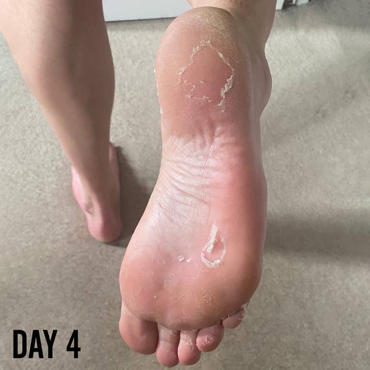 BARBER PRO - Wholesale Foot Mask - BARBER PRO Foot Peel - Prep the feet for Summer!
