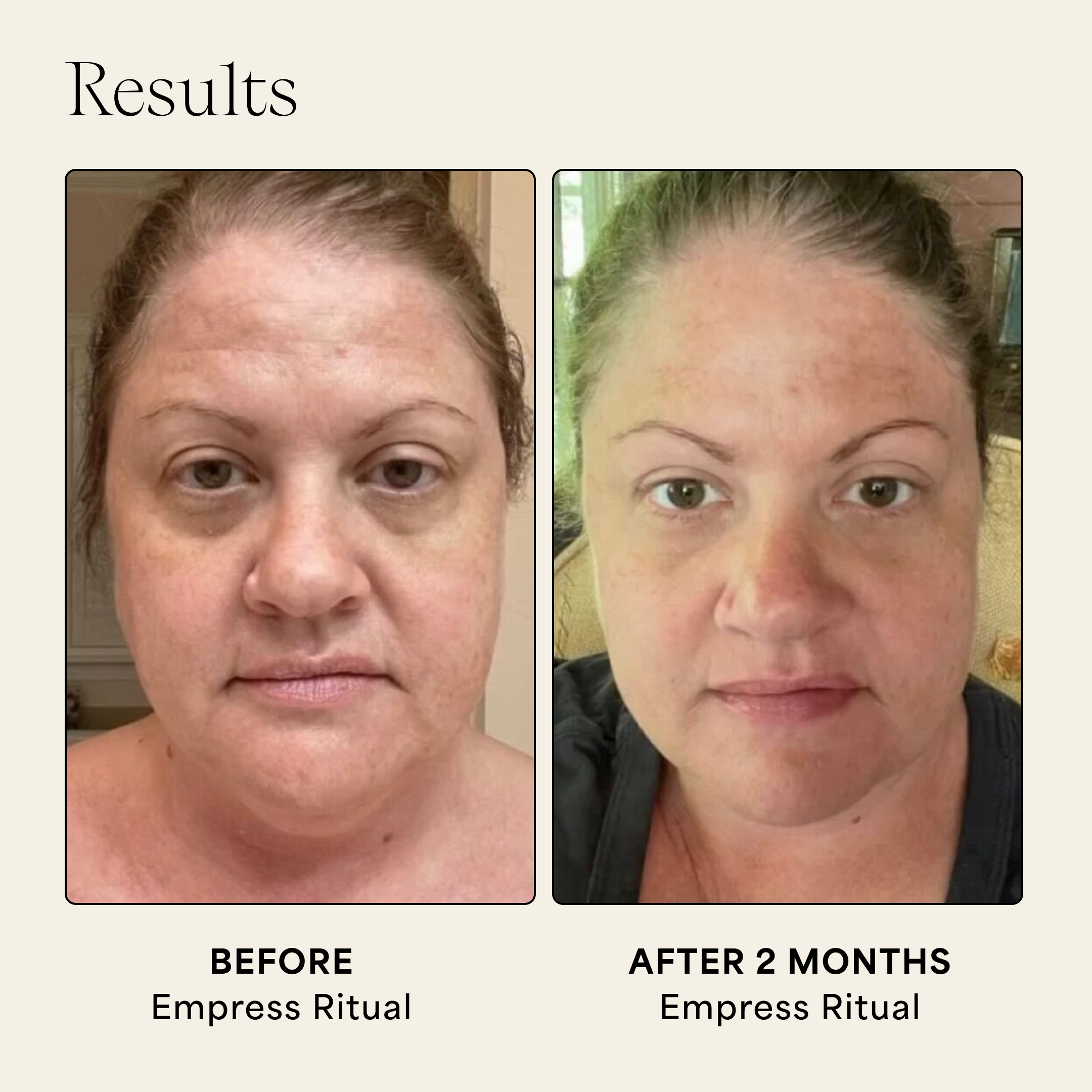 Wildling - Wholesale Facial Oil - Empress Barrier Repair Oil1