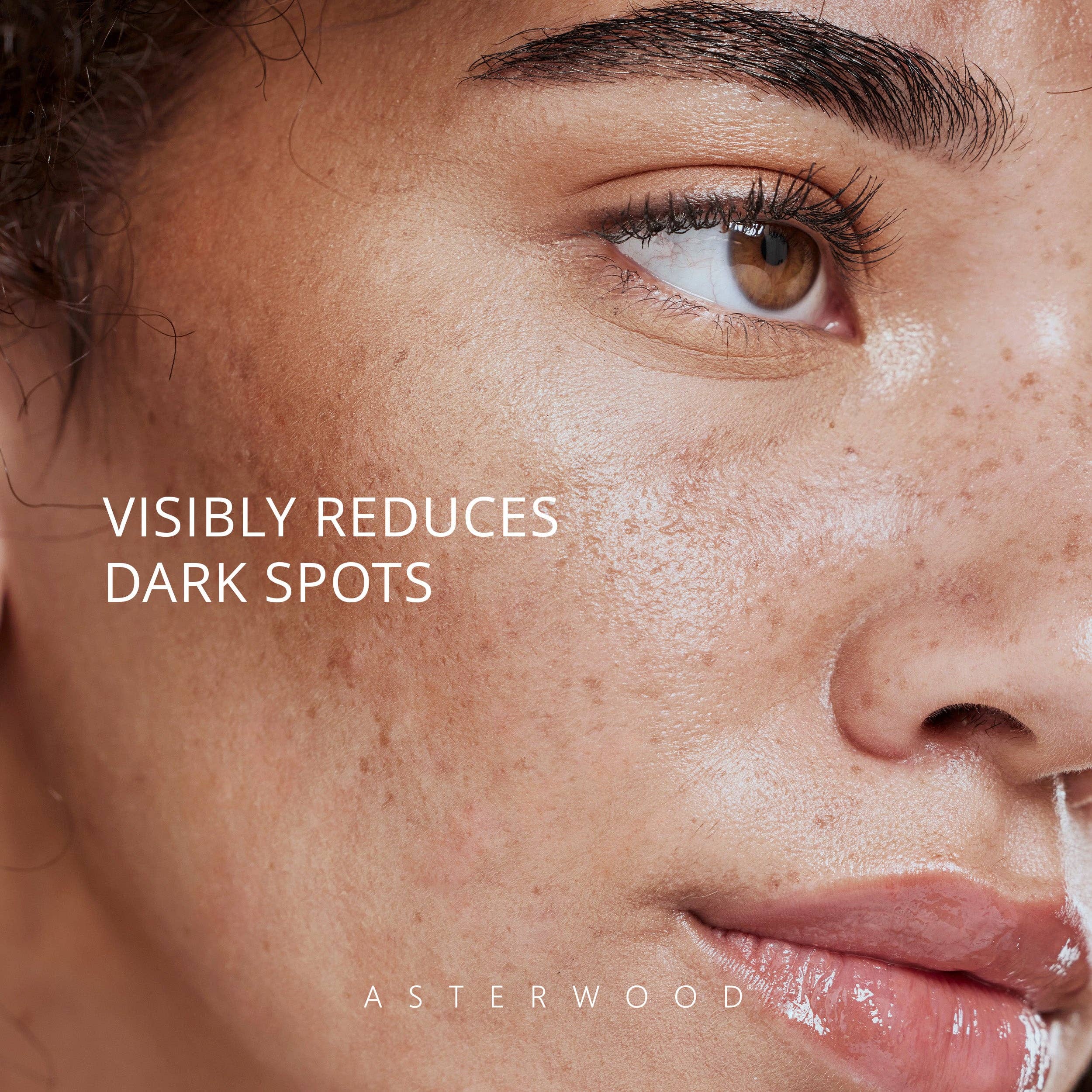 Asterwood - Wholesale Facial Serum/Concentrate - Dark Spot Corrector Serum3