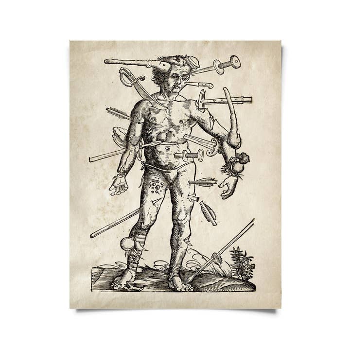 Vintage Anatomy Wounded Man Print w/ optional frame for wholesale by Curious Prints