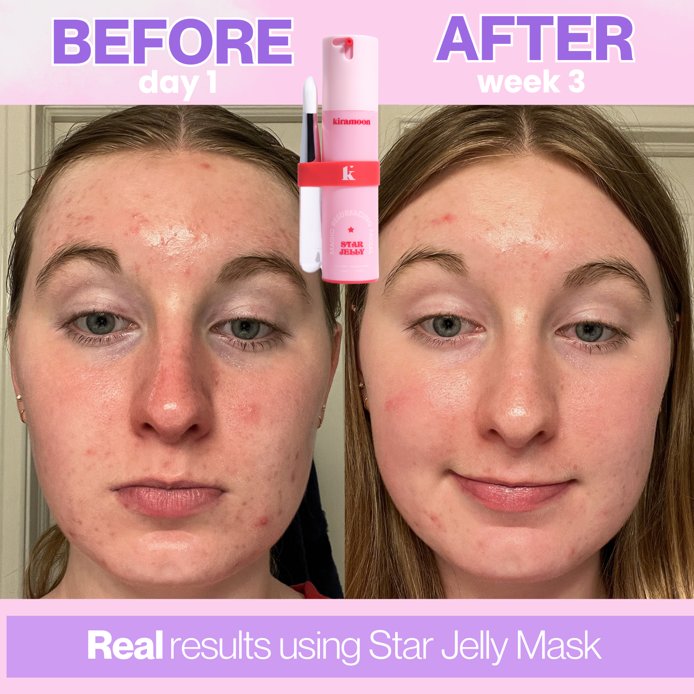 Kiramoon - Wholesale Skincare Face Mask - Star Jelly 10% AHA Resurfacing Facial Mask4