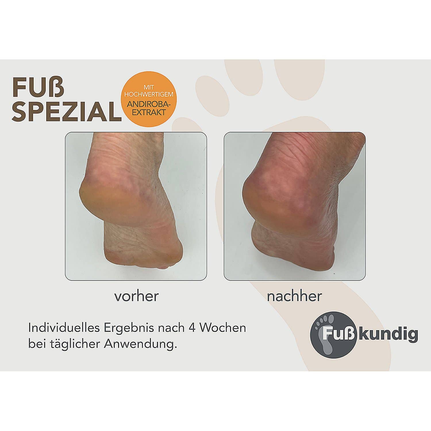 Fußkundig - Wholesale Foot Cream - Foot special care foam against calluses and cracks 150 ml1