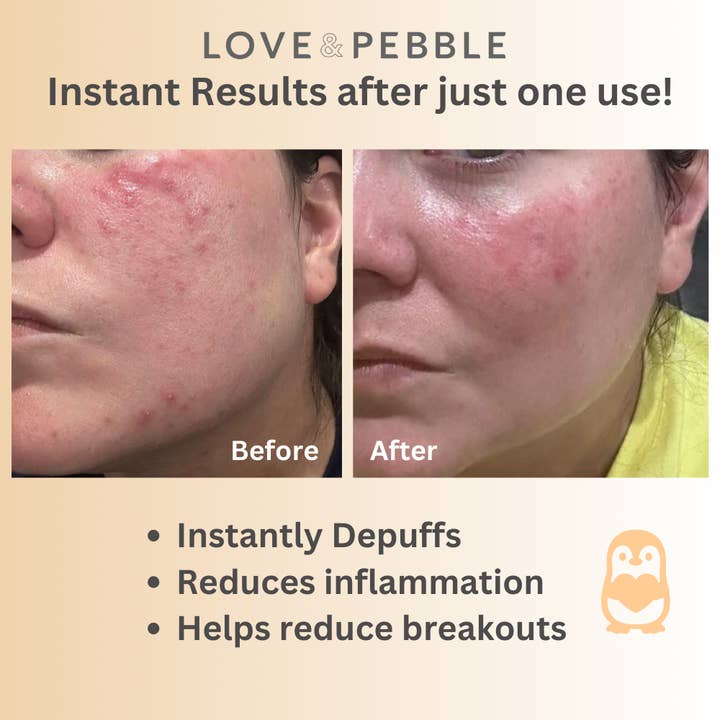 Love & Pebble - Venta al por mayor Mascarilla - Bandeja para mascarillas de hielo - Skincare Ice Facial TikTok Viral Shark Tank