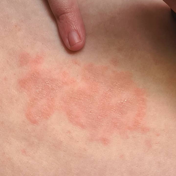 Nancy Natural Beauty Skincare - Vendita all'ingrosso Crema/lozione corpo - Sapone e crema naturali contro la tricofitosi5