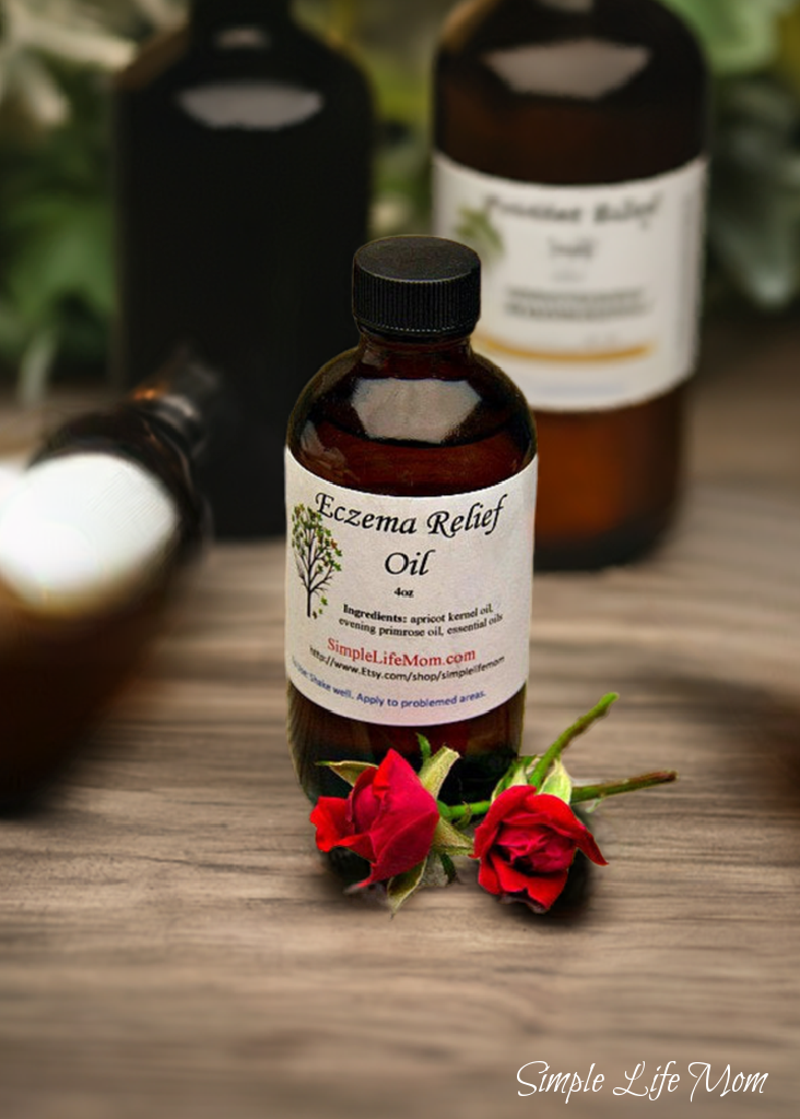 Simple Life Mom - Wholesale Bath/Body Oil - ECZEMA RELIEF OIL - 4oz soothe irritated, dry skin, organic body oil with essential oils, dermatitis oil3