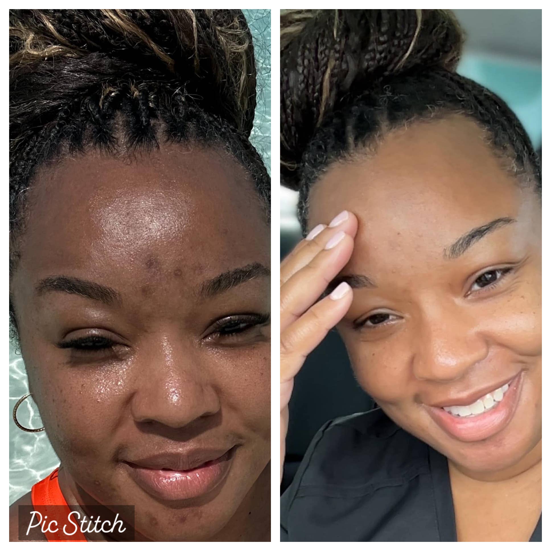 SaraBale Beauty - Wholesale Body Scrub/Exfoliant - SaraBale Turmeric & Kojic Powder Face/Body Bar1