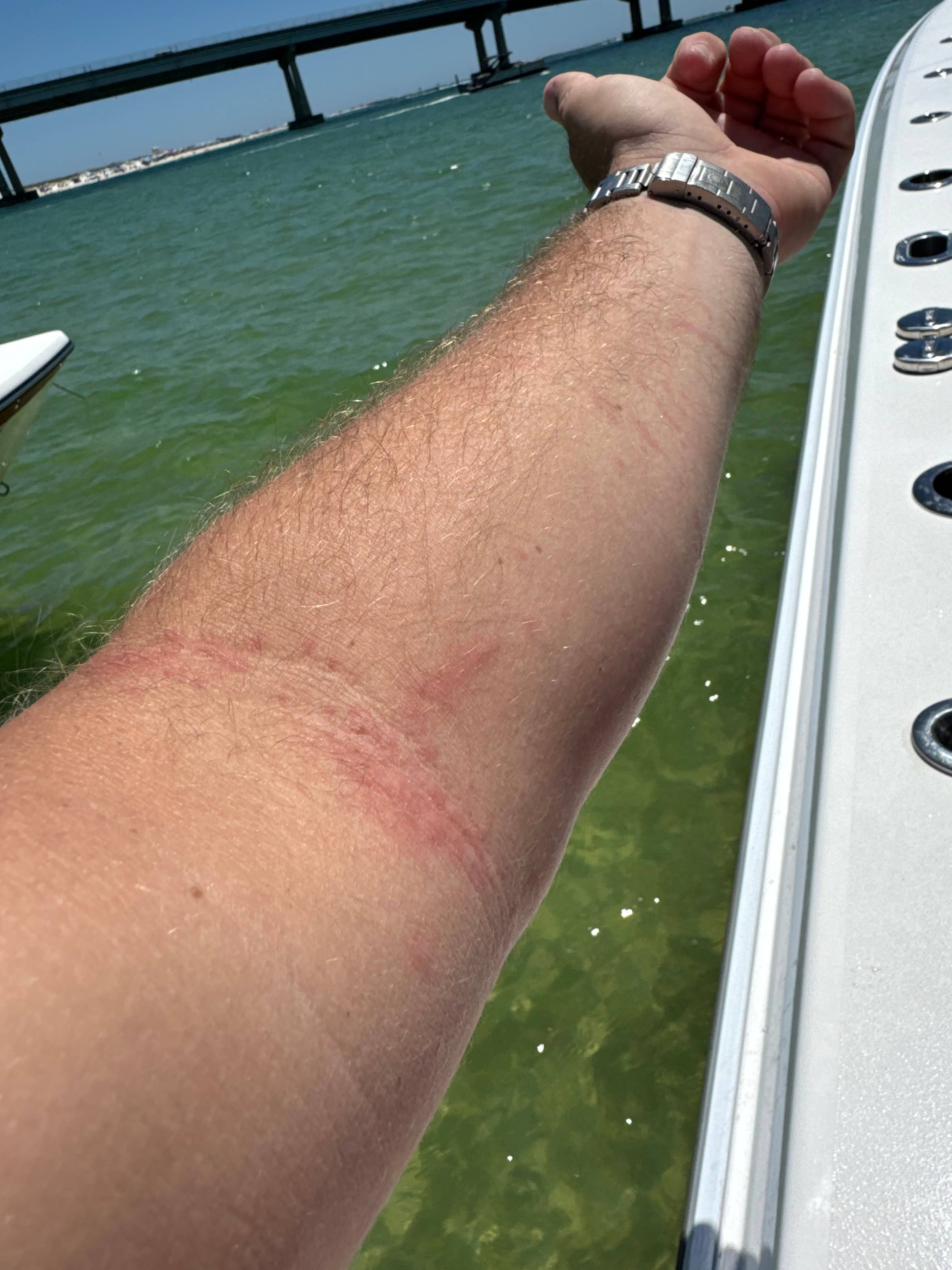 Jelly-Smack – wholesale Pain relief spray/cream – Jelly-Smack - Bite and Sting Treatment9