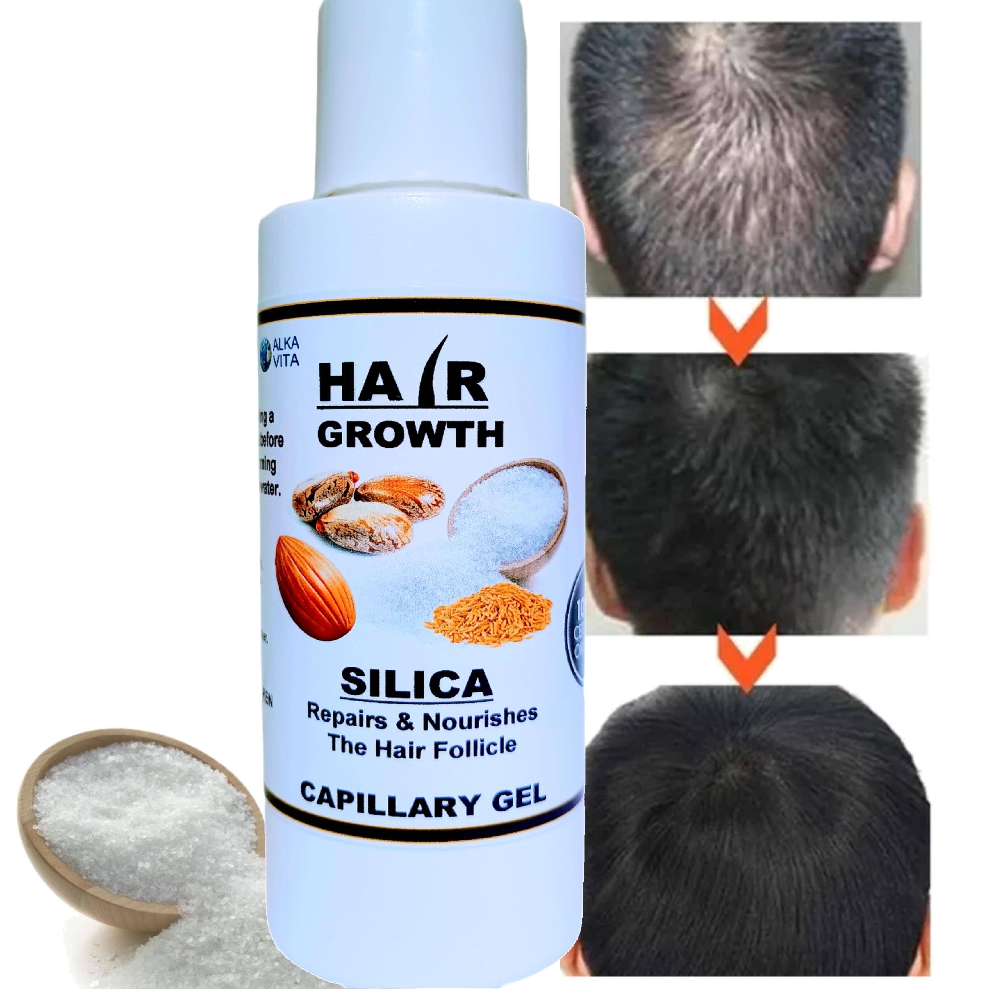 AlkaVita - Wholesale Hair Thinning/Loss Treatment - Hair Loss Growth Gel Silica Cactus Rice Biotin Almond Oil
1