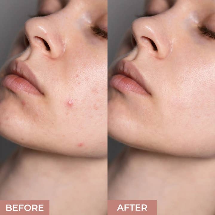 VIAI Beauty - Wholesale Face Makeup Primer - Pore Concealing Primer by Prolux8