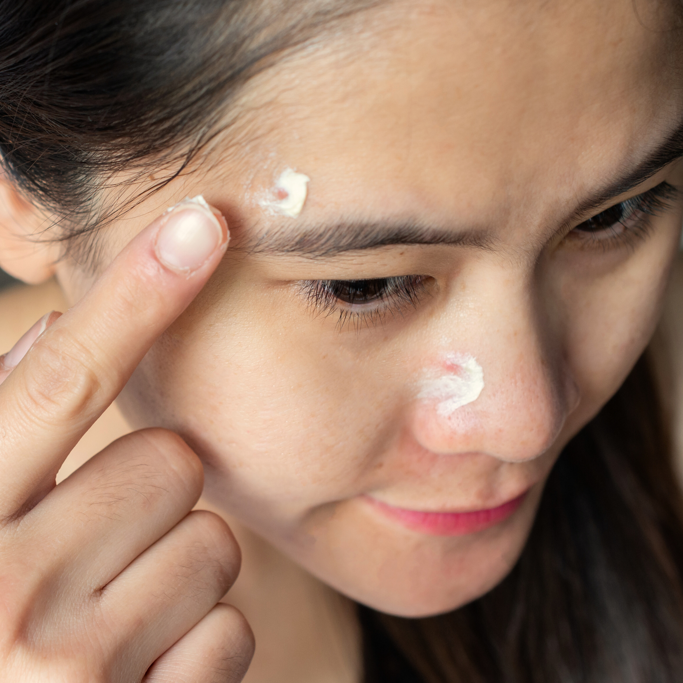 Mettalusso Inc - Wholesale Acne/Hydrocolloid Patch - Mettalusso MORIIS Modern Acne + Anti-Oxidant Hydrating Skincare Lotion7