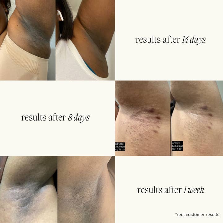 Forgotten Skincare - Wholesale Deodorant - Women's - The Original Underarm Brightening Deodorant Cream4