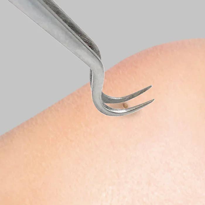 Lindo - Wholesale Tweezers - Lindo Black Out Blackhead Tweezer