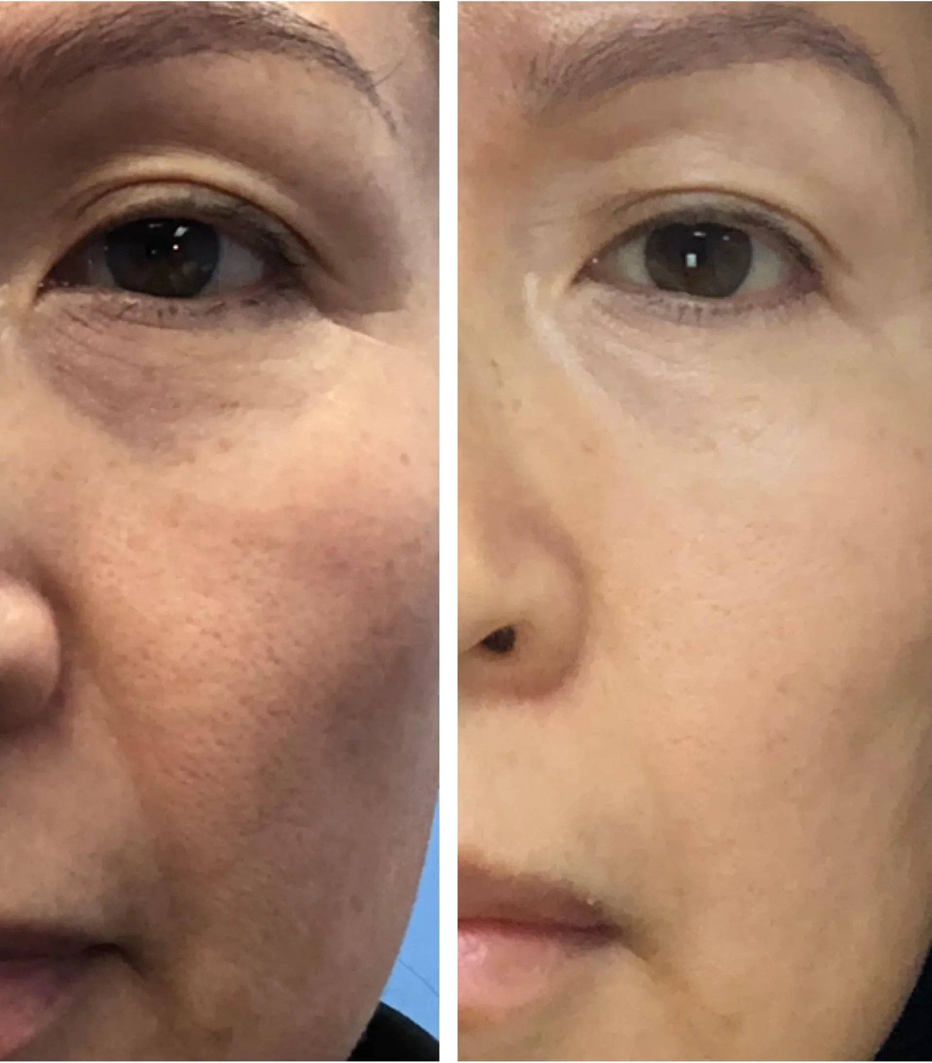 EMANI VEGAN COSMETICS - Vente Ensemble/coffret de soins du visage - Kit peau parfaite6