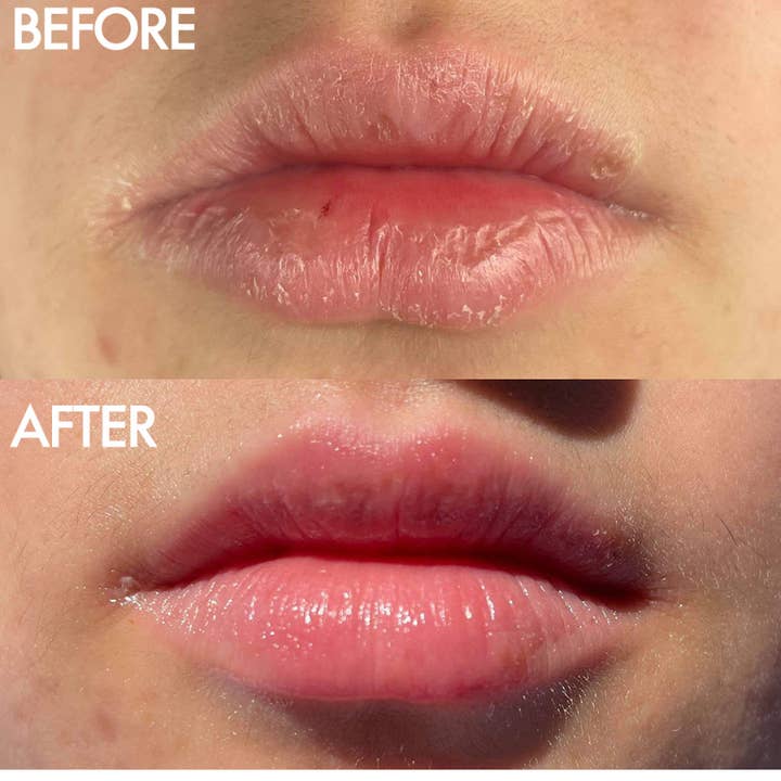 Lanolips - Wholesale Lip Balm - The Original 101 Ointment Multipurpose Superbalm1