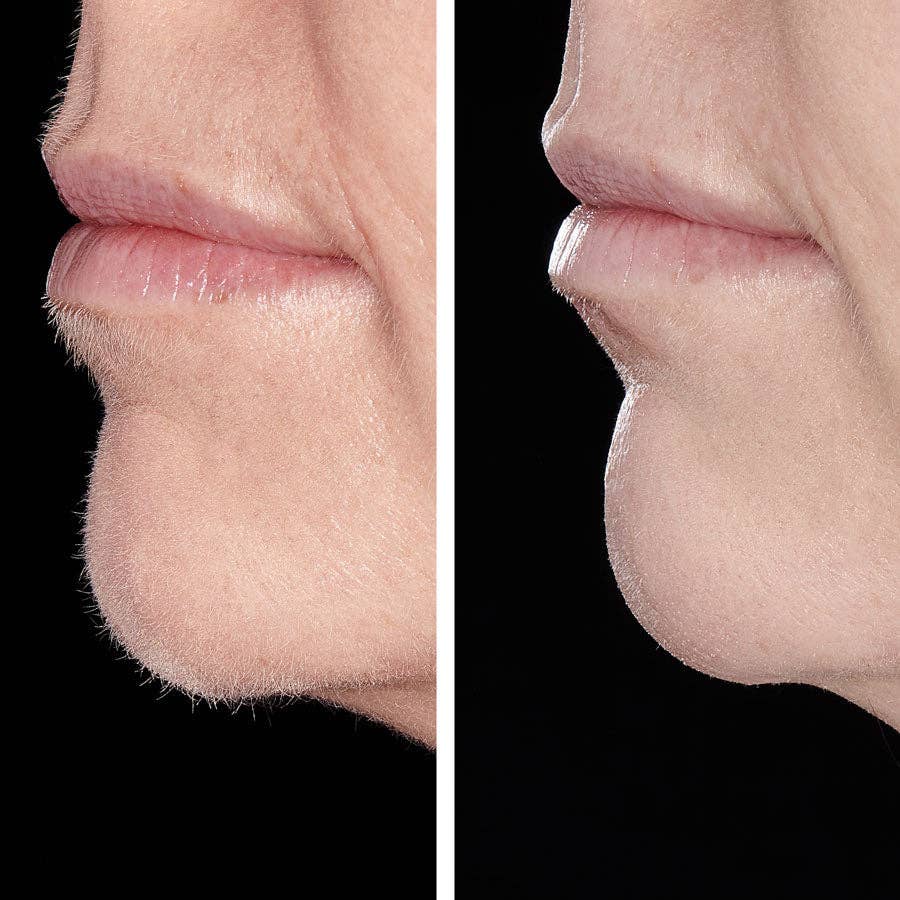 Hollywood Browzer Beauty – wholesale Electronic skincare device – HOLLYWOOD SMOOTHER - SONIC DERMAPLANER3