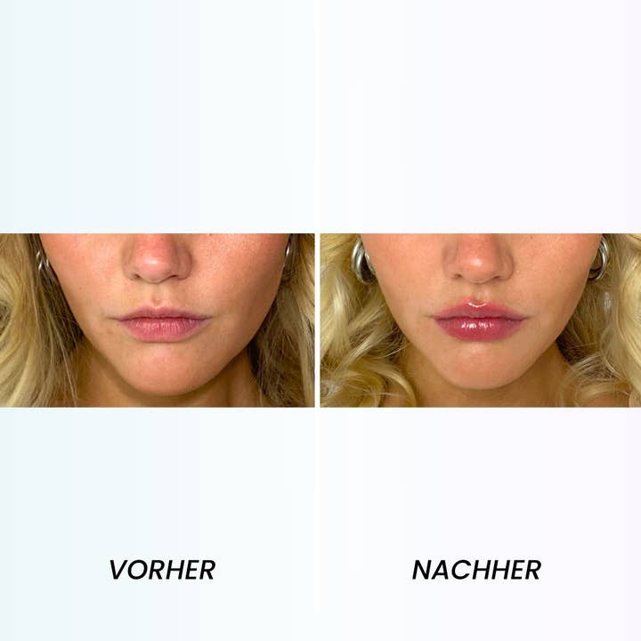 VENICEBEAUTY - Wholesale Lip Gloss - Lip plumper9