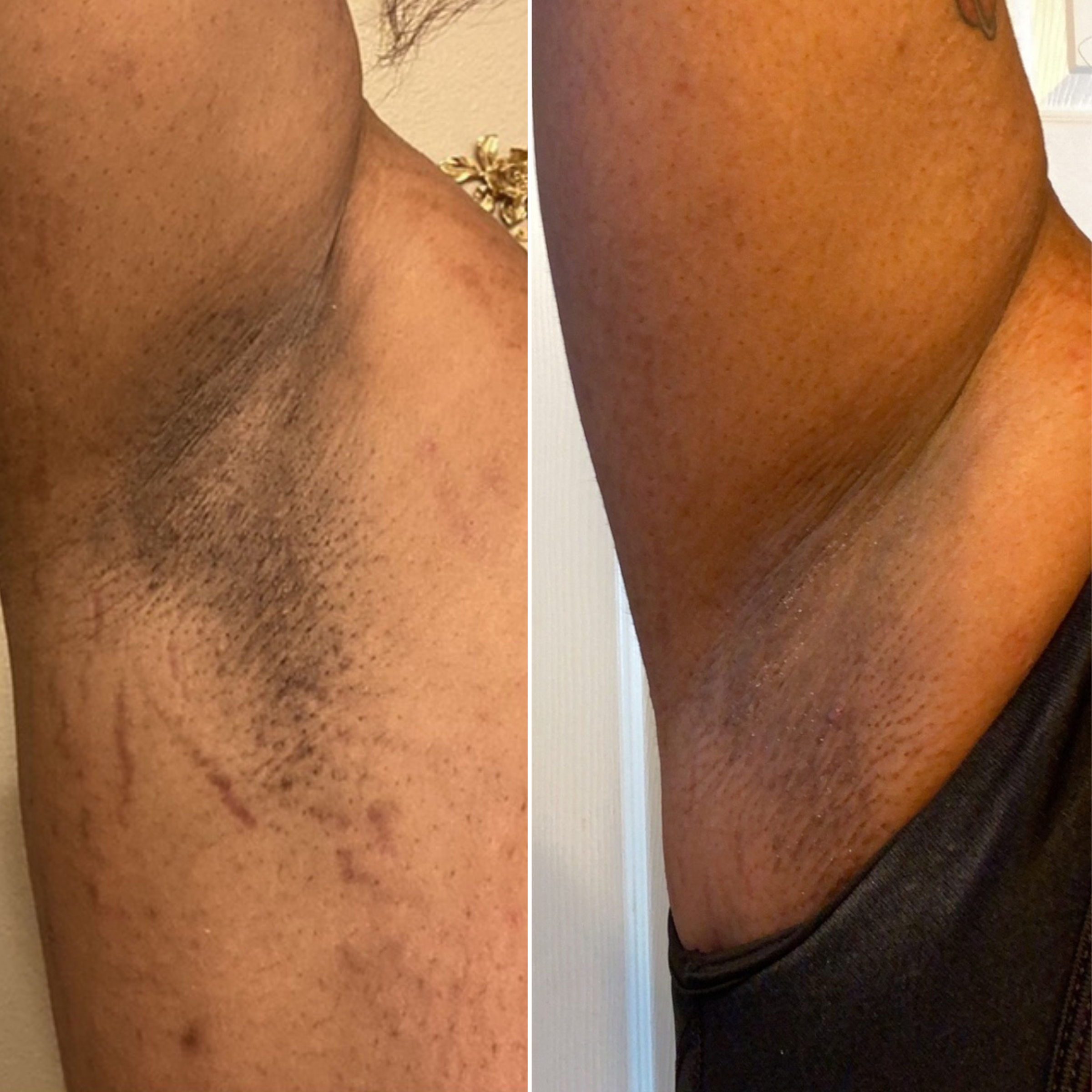 Bushbalm - Wholesale Body Scrub/Exfoliant - Dark Spot Exfoliating Scrub (Bermuda)2