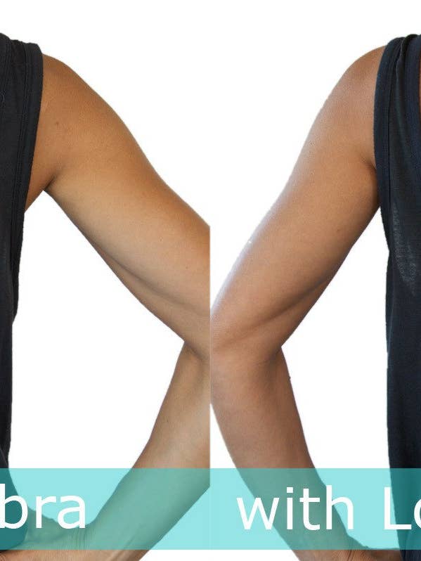 Lave forventninger kaster tilbage Bra Converter Strap for engroshandel hos Fashion First Aid