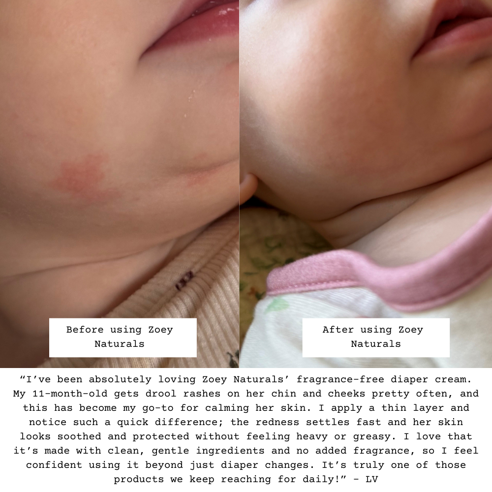 Zoey Naturals - Wholesale Diaper Cream - Fragrance Free Diaper Cream - 3.4oz4