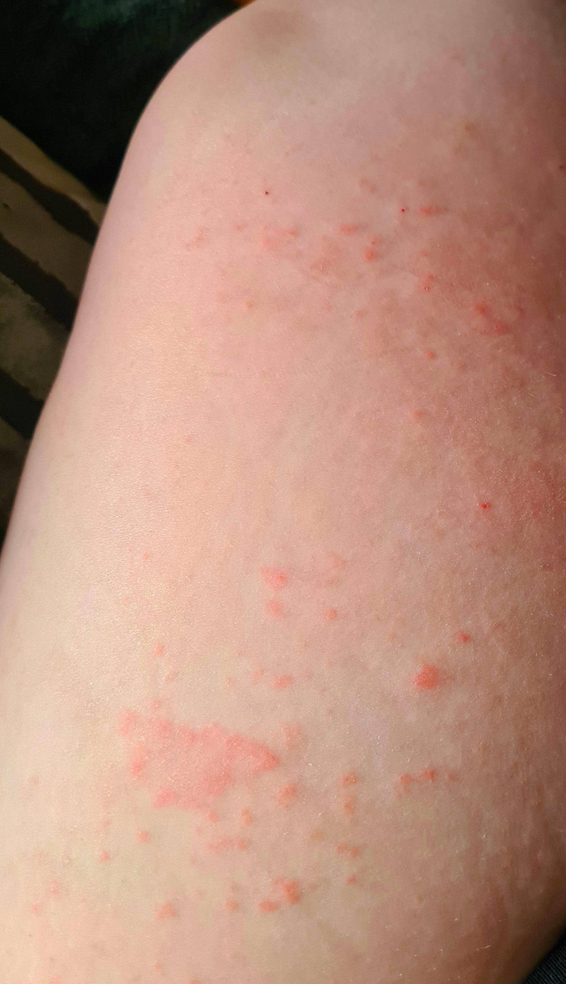 Nancy Natural Beauty Skincare - Wholesale Body Cream/Lotion - Natural Ringworm  Soap & Cream6