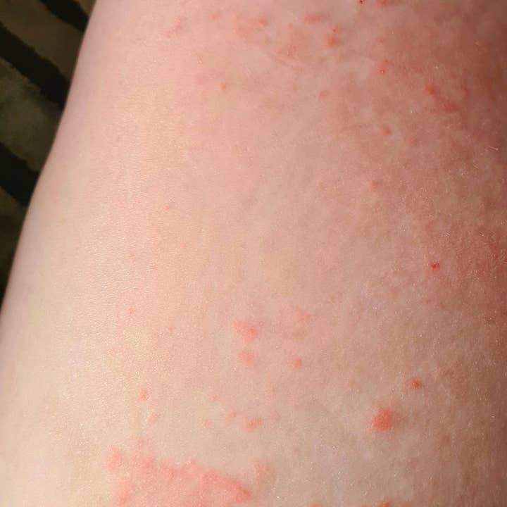 Nancy Natural Beauty Skincare - Vendita all'ingrosso Crema/lozione corpo - Sapone e crema naturali contro la tricofitosi6