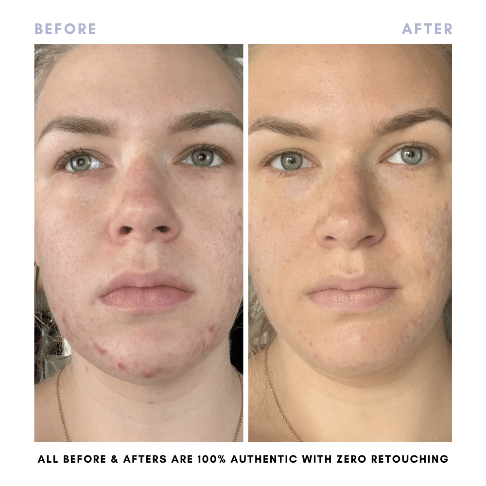 Clover By Clove + Hallow – Großhandel Gesichtspflege-Set – Das Juicy Skin Set8