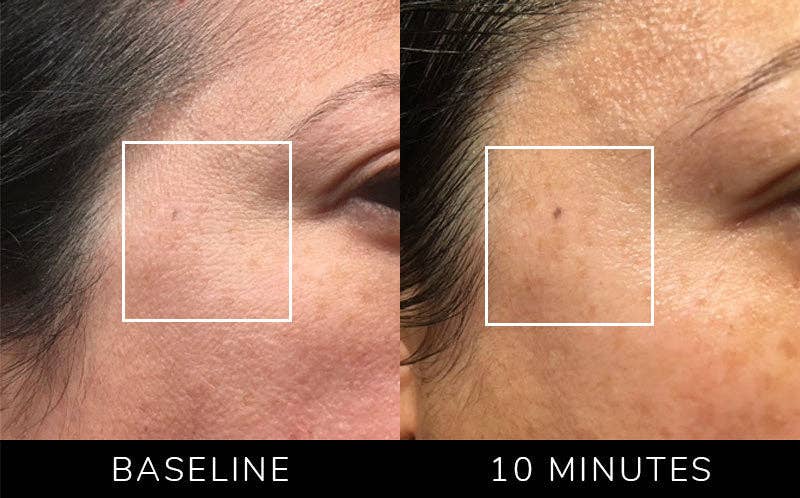 Nature Checkout Inc - Wholesale Electronic Skincare Device - Eno Patented All-In-One Skincare Device. The one device that does it all - exfoliation;  product infusion & facial sculpting10