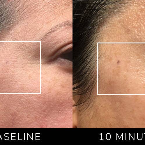 Nature Checkout Inc - Wholesale Electronic Skincare Device - Eno Patented All-In-One Skincare Device. The one device that does it all - exfoliation; product infusion & facial sculpting10