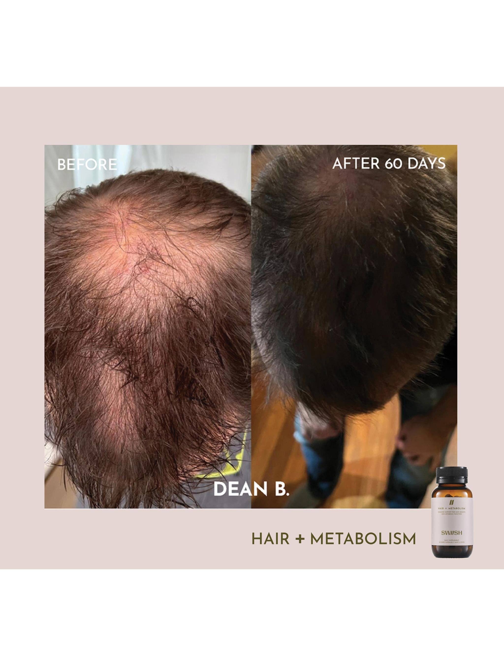 SWIISH - Wholesale Oral supplement/vitamin - Hair + Metabolism9