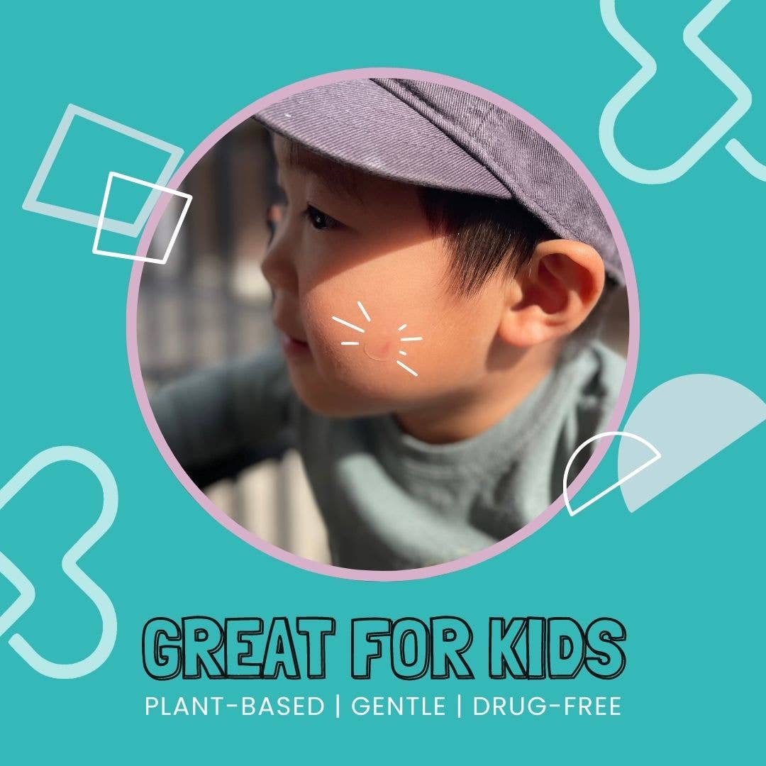 Quelly - Wholesale Itch Ointment/Cream - Quelly ItchGuard2