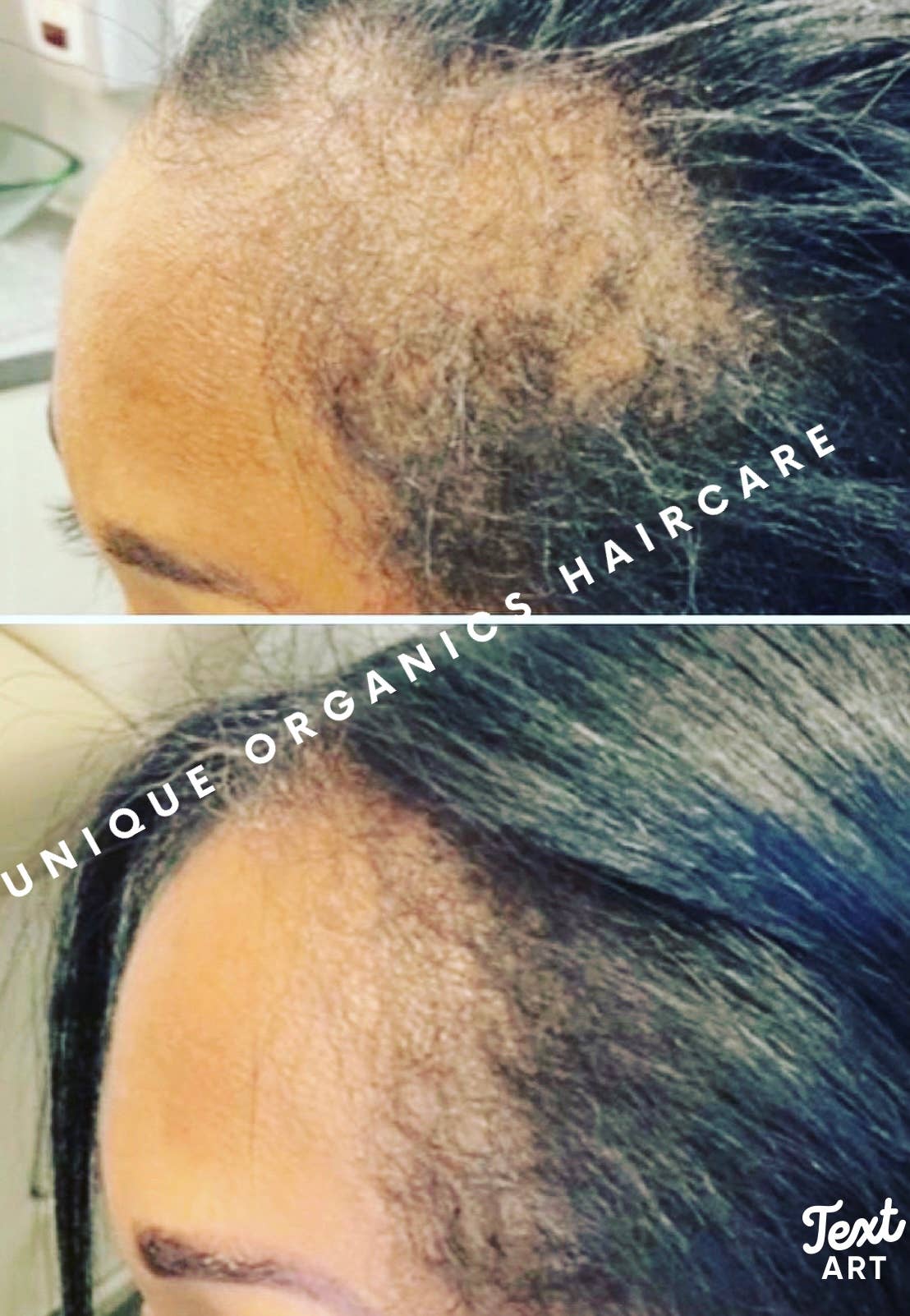 Unique Organics Haircare - Venta al por mayor Aceite capilar - Aceite para el cabello con 40 ingredientes contra la alopecia2