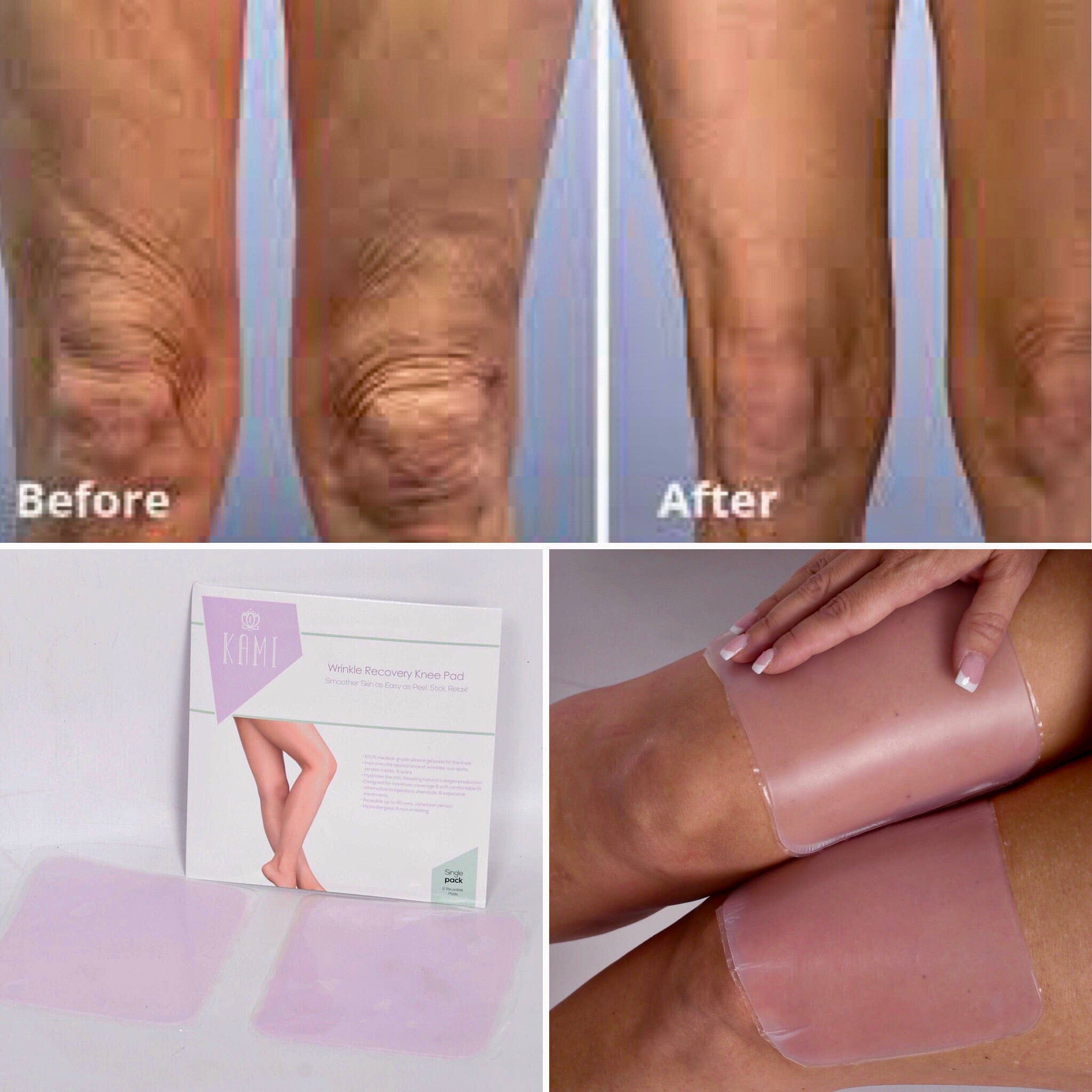 Kami Pure - Anti-Aging Silicone Gel Pads - Wholesale Anti-Aging Moisturizer - Knee Wrinkle Silicone Pad – Dermatologist, Med Spa2