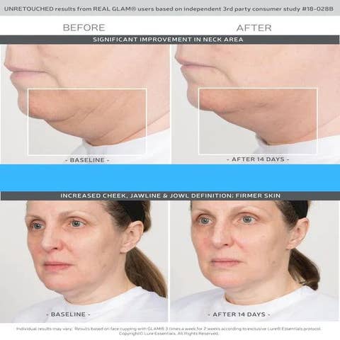Wholesale Facial Rejuvenation Massage Cupping Set for Face, Eyes