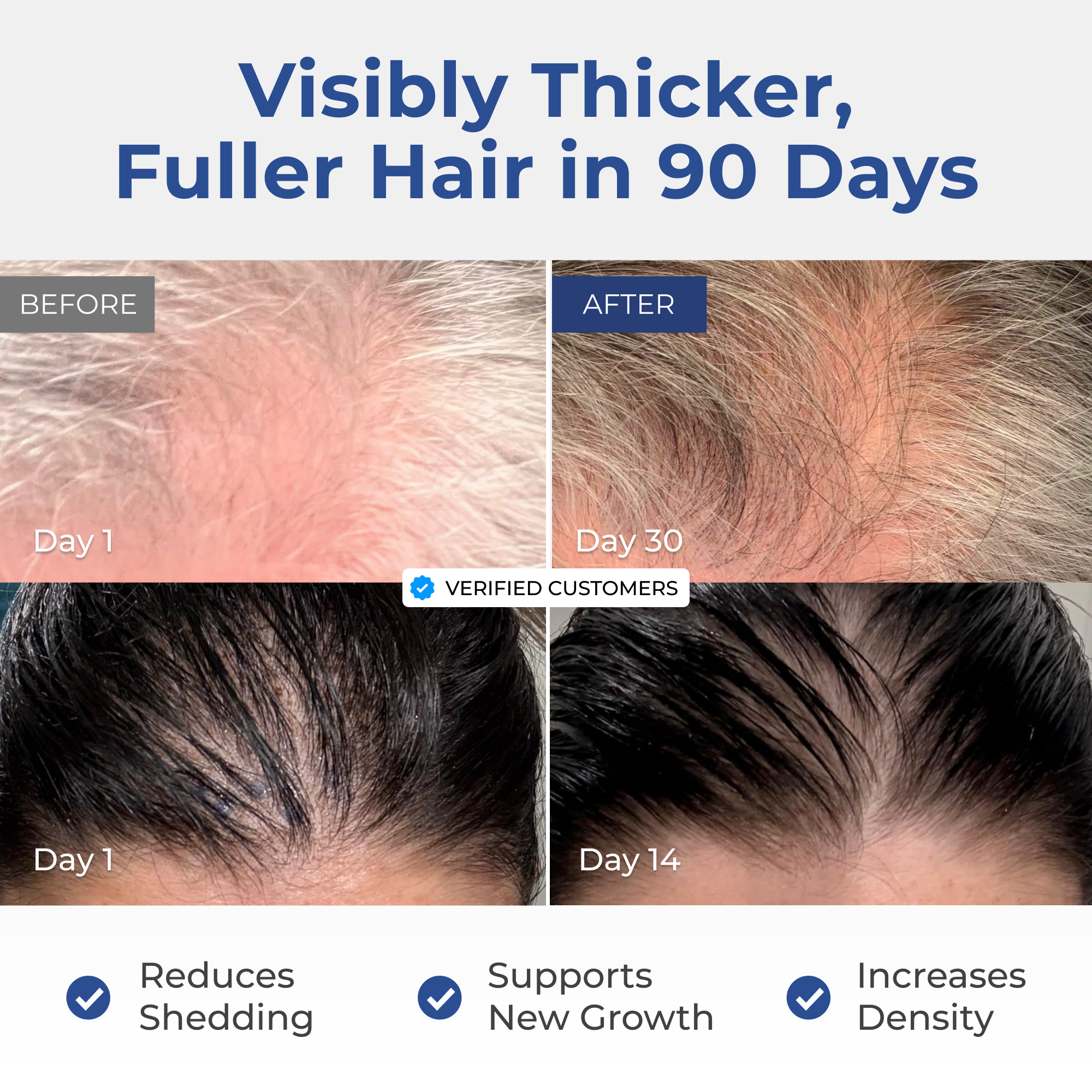 Neurogan Health - Wholesale Hair Serum - GHK-Cu Copper Peptide Hair & Scalp Serum1