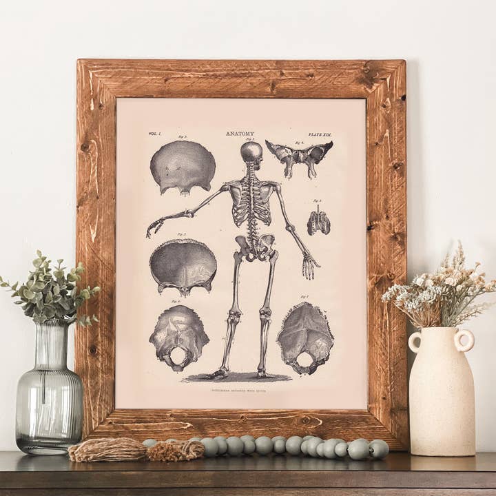 Vintage Skeleton Anatomy Print Framed Medical Wall Art for wholesale by Swinford Designs