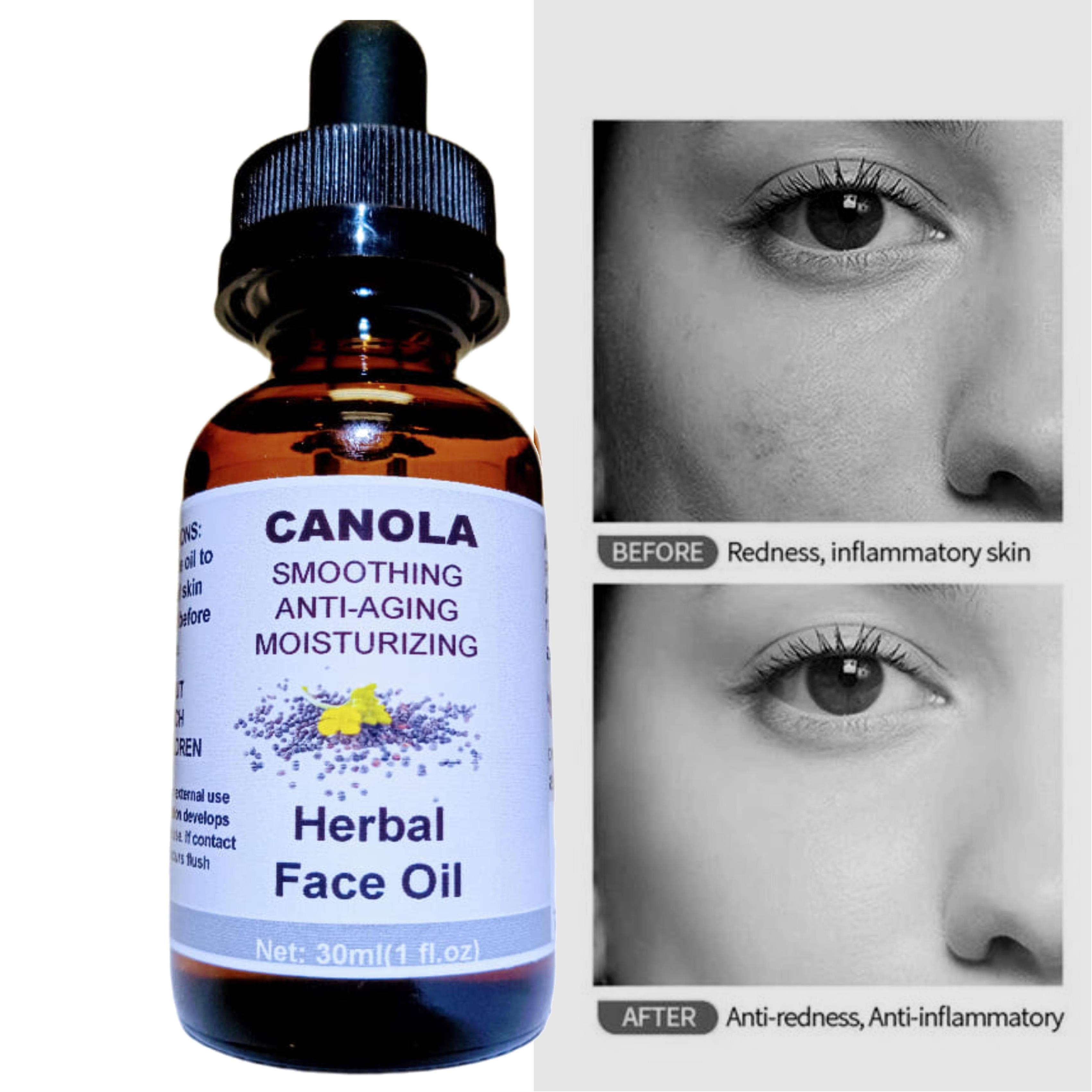 AlkaVita – Großhandel Anti-Aging-Feuchtigkeitscreme – Rapssamen-Kräuteröl für das Gesicht, glättend, antialternd, feuchtigkeitsspendend1