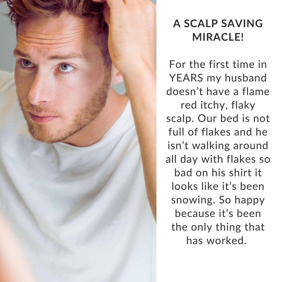 Allay Organics - Wholesale Scalp/Hair Treatment - Scalp Therapy- Leave In Treatment for Psoriasis Prone Scalp6