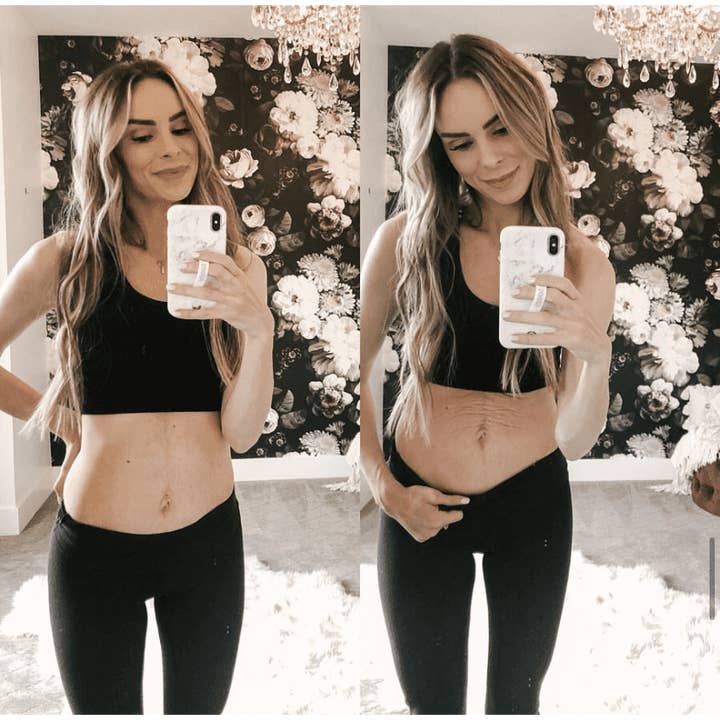 The Spoiled Mama – Óleo de barriga/manteiga - Maternidade por atacado – Creme de Manteiga para Estrias Pós-Gravidez1