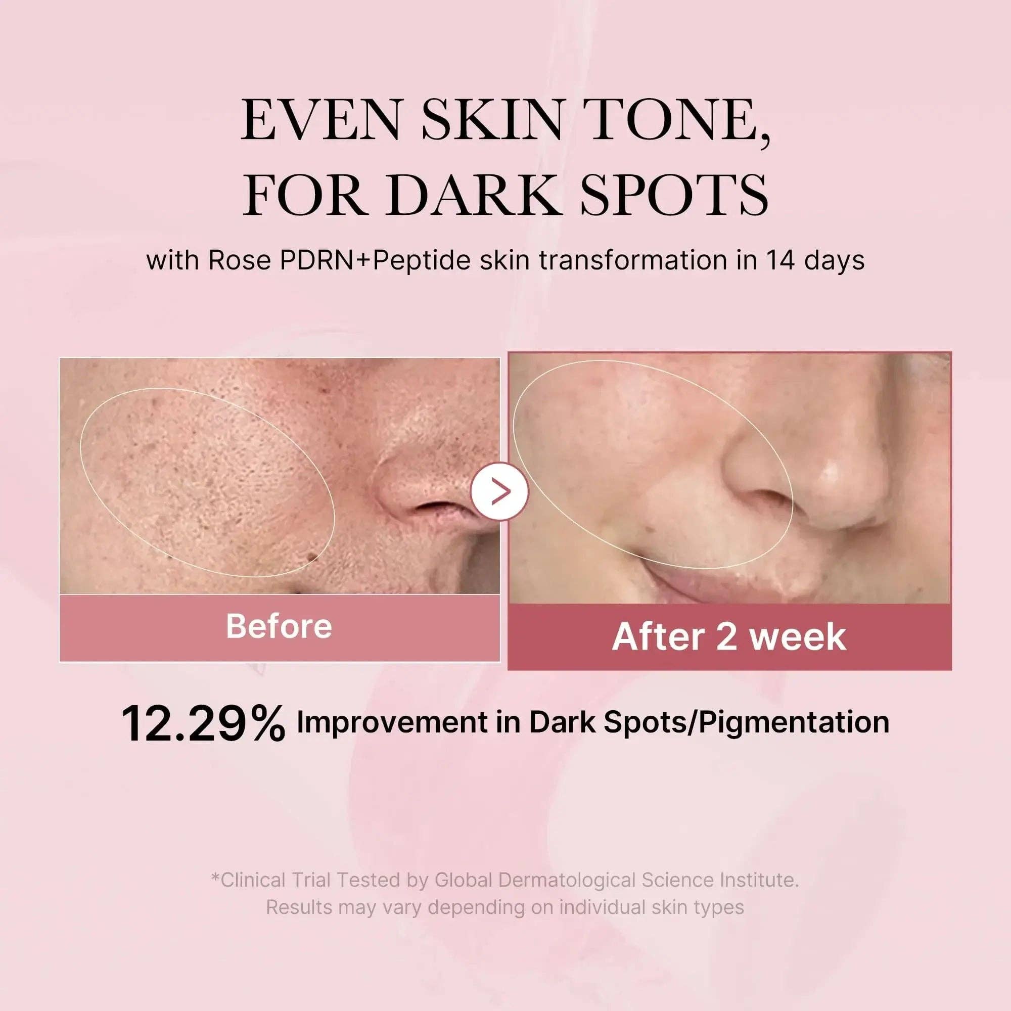 SKEEN - Wholesale Facial Toner - MEDICUBE PDRN Pink Cica Soothing Toner 250ml2