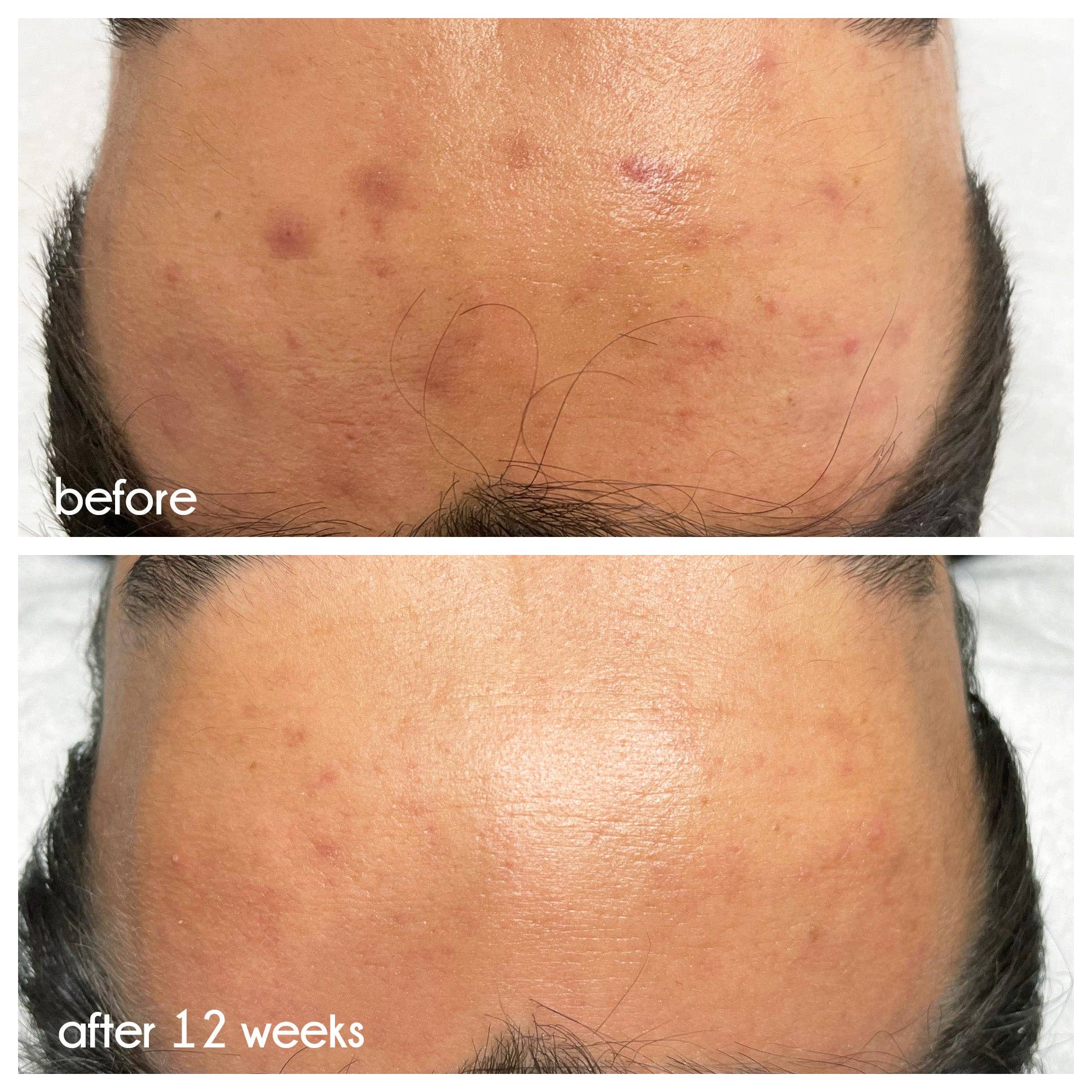 >beauty - Wholesale Facial Serum/Concentrate - Clean Slate Serum3