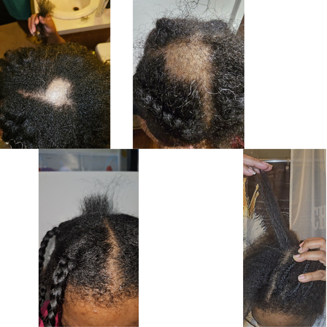 Queen's Abundance Krown - Wholesale Hair Oil - Nourishing Growth Rosemary Hair Oil | Strengthen, Hydrate & Promote Healthy Hair 4oz12