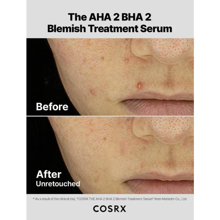 Best Beauty Group - Wholesale Facial Serum/Concentrate - COSRX AHA 2 BHA 2 Blemish Treatment Cotton Balls Serum